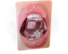 𝕄✓ Ice