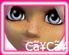 CaYzCaYz Freckled
