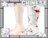 ᢉ𐭩 broken leg
