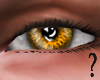 MS- Amber Eye