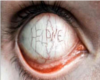 [Cyn]Zombie eyes