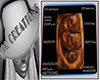 iQ Eyvie Ultrasound Pics