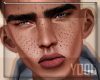 Freckles ♂