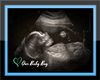 Our Baby Boy Scan