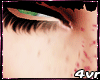 Freckles►F