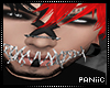 ✘ Wired Shut