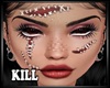 Stitches