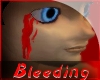 Bleeding Eye