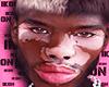 Vitiligo Man Head