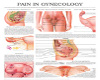  PAIN IN GYNO CHART
