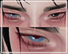 ♰ Heterochromia - B/B