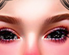 (MD) Black eyes