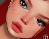 Kiza T2 + Freckles