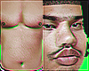 Skin Fat Body