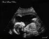 Brooks Ultrasound 4mth