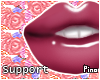 P! 10k Support Sticker