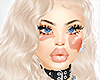 Vitiligo Light Skin