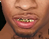 RAPPERS GOLD Teeth