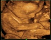 Becki's 1st ultrasound