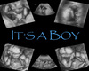 It's A Boy HH Ultrasound