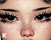 Freckles v2