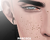 P Freckles
