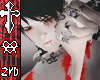 Negative