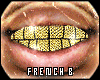 Realistic Gold Grillz