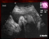 6M Ultrasound Frame {MS}