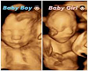 Twin Ultrasound Pic
