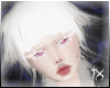 Albinism