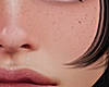 Freckles