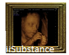 |SS| Ultrasound Pic Fram