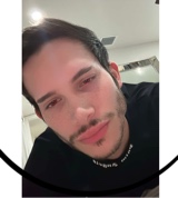 NACBV