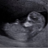 Guest_babyboyy01